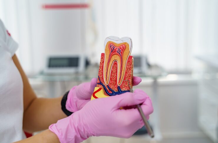 When Do You Need a Root Canal Treatment?