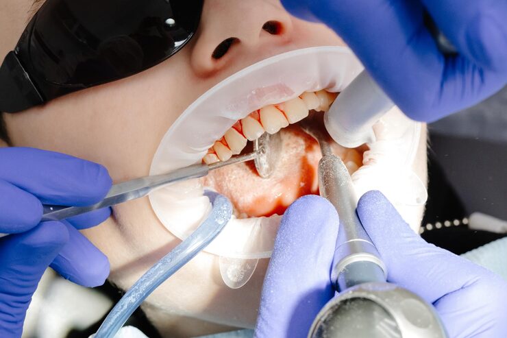 Gum Disease (Periodontal) Treatment